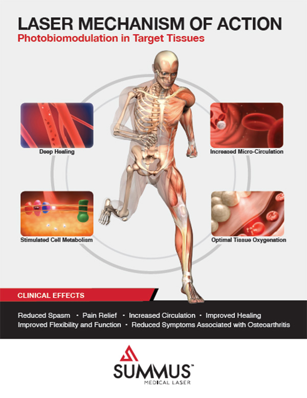 Chiropractic Durham NH laser mech